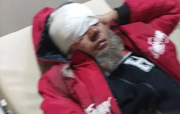  في الجمجمة.. كلاب ضالة تتسبب في إصابة مُسن في بورسعيد