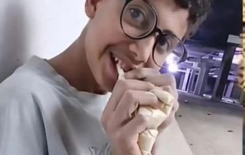 المؤسسة العلاجية تستجيب لحالة جلال "شاب القرنية" وتوجه بعلاجه فوراً بمستشفى مبرة المعادي