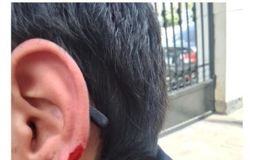 قطع أذن زميله 