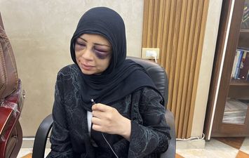 الاجهزة الامنية بمحافظة بورسعيد تلقى القبض على الشاب المعتدى على خطيبته السابفة " كوافيرة بورسعيد "