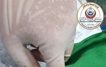 العملية 