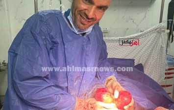 العملية 
