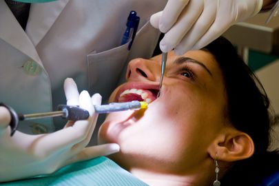 البنج لأطباء الأسنان