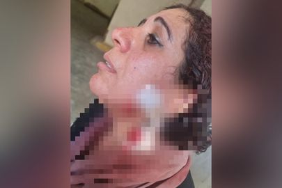 الزوجة ضحية طعـ.ـن زوجها بمحكمة الأسرة