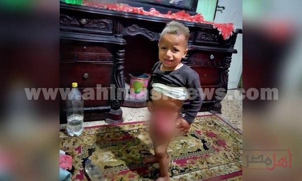 طفل أبو حمص