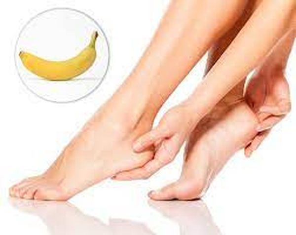 قناع الموز لتشقق القدمين