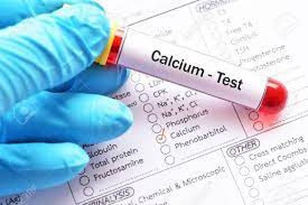 ارتفاع نسبة الكالسيوم في الدم
