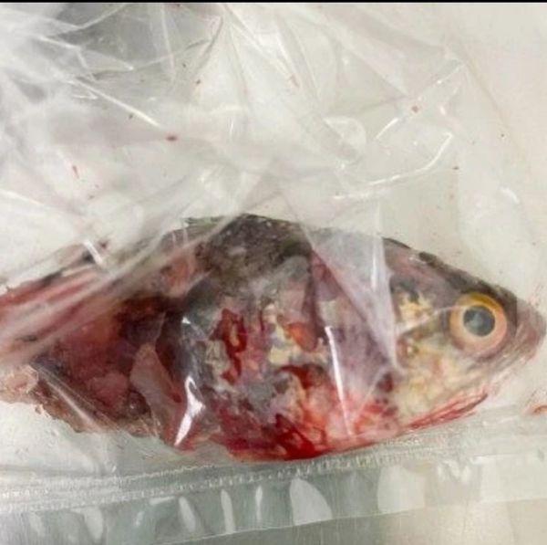 سمكة تقفز في فم صياد ويخرجها بعملية جراحية 