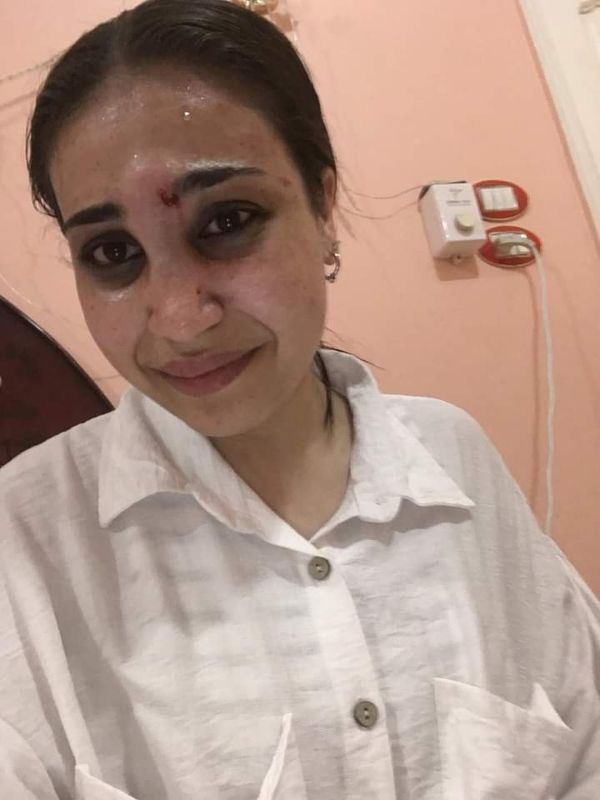 ريهام ضحية العنف الأسرى