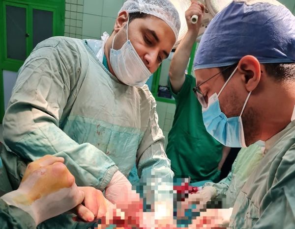 فريق طبي ينجح في إنقاذ شاب مصاب بانسداد في الأمعاء 