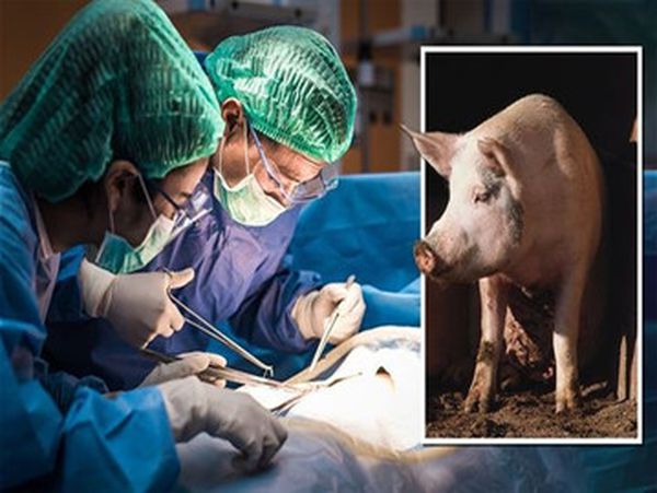 نجاح عملية زرع كلية خنزير في جسد إنسان
