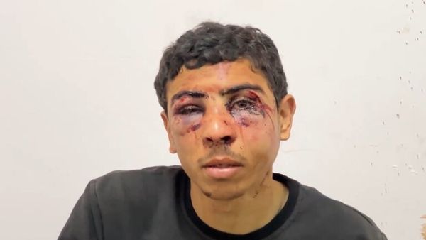أحد ضحايا التعذيب السادي للجيش الاسرائيلي