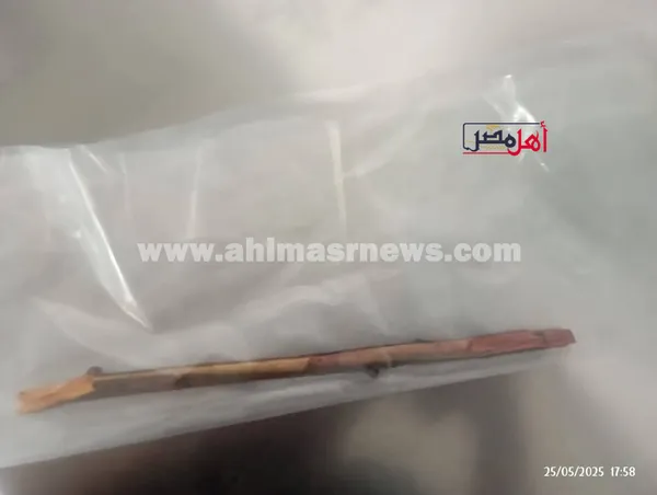 جانب من الجراحة 