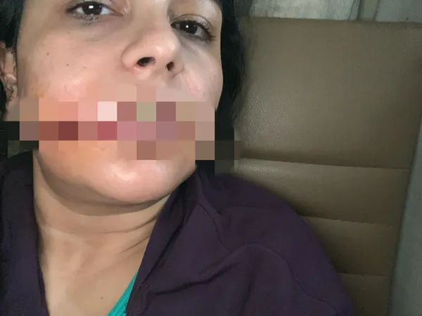 منى ضحية زوجها ببورسعيد 
