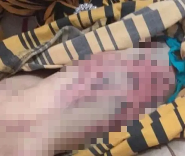 عروس بني سويف ضحية ضرب وتعذيب زوجها