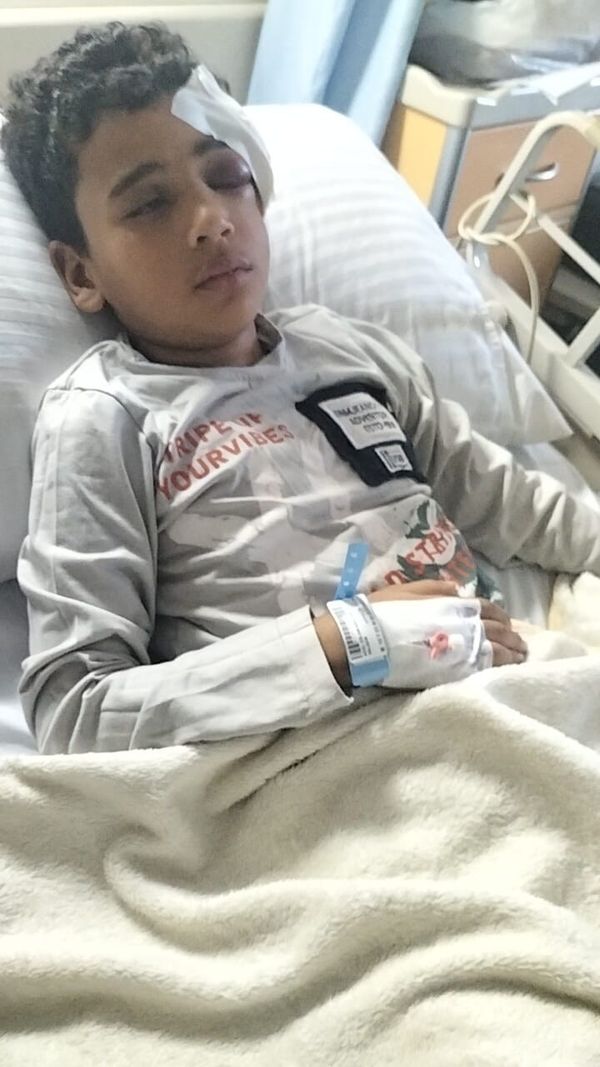 الطفل المصاب