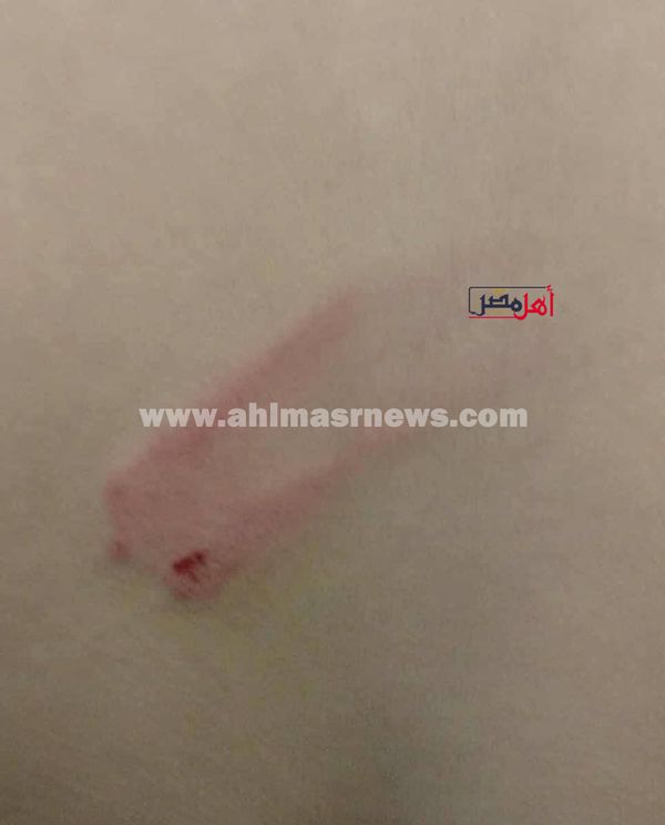 جانب من الاعتداء