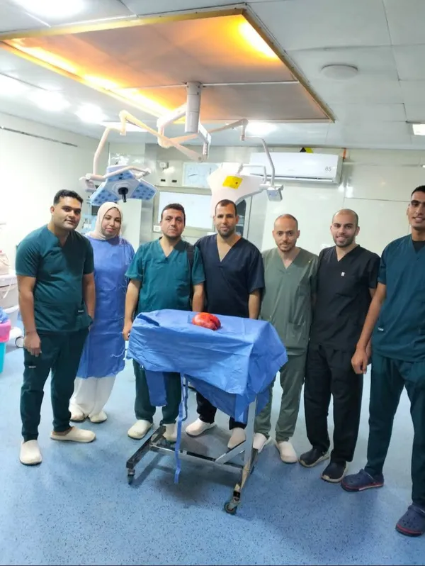 استئصال ورم من بطن مريض بمستشفى كفر الشيخ العام 