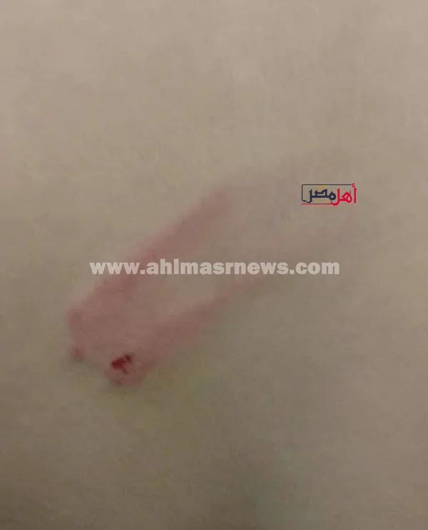 جانب من الاعتداء