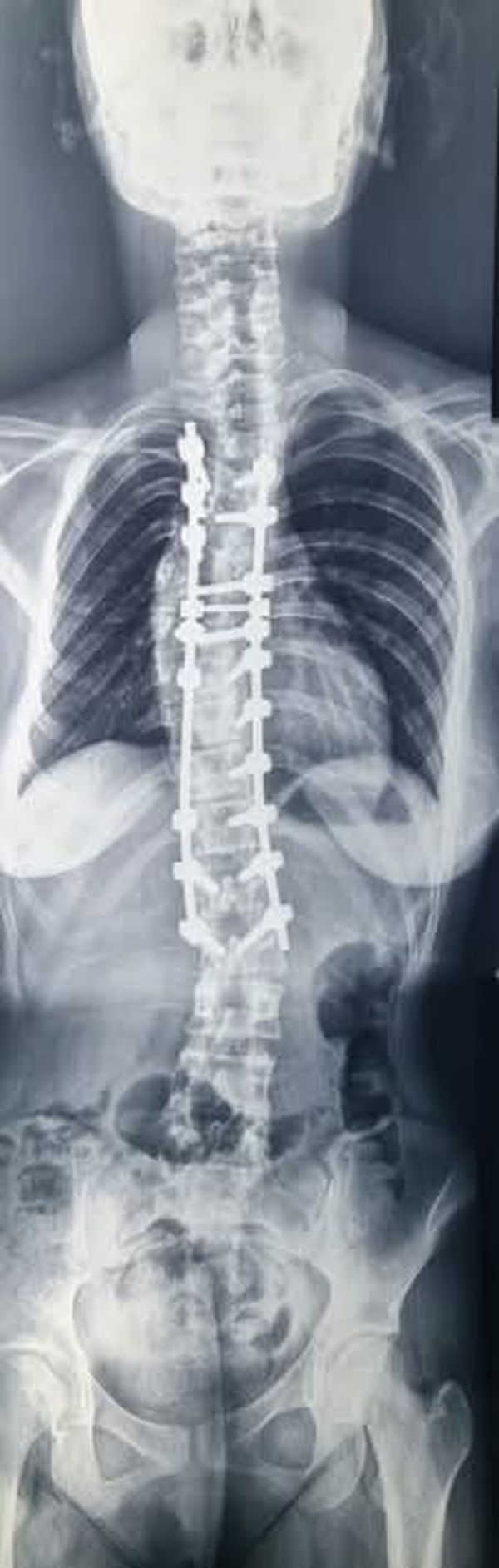 جانب من العملية الجراحية