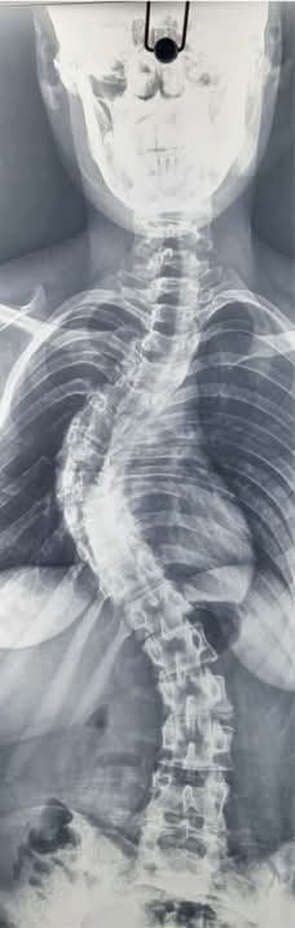 جانب من العملية الجراحية