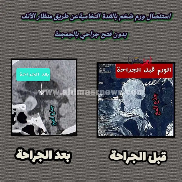 جانب من العملية الجراحية 