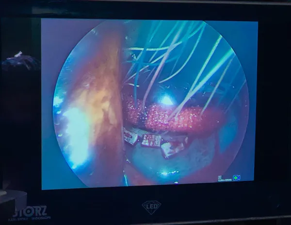 جانب من العملية الجراحية 