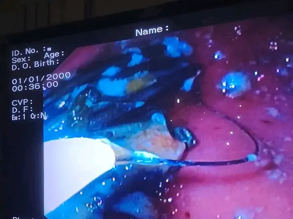 جانب من العملية الجراحية 