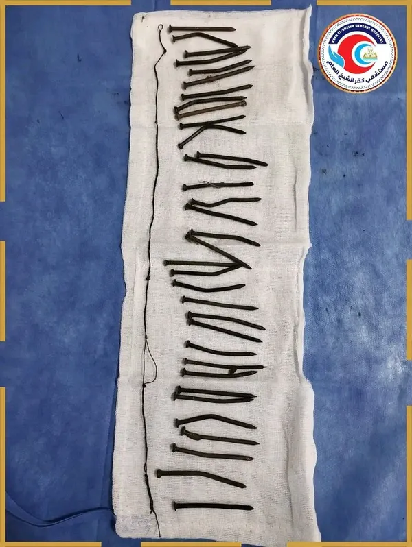 جانب من العملية الجراحية 