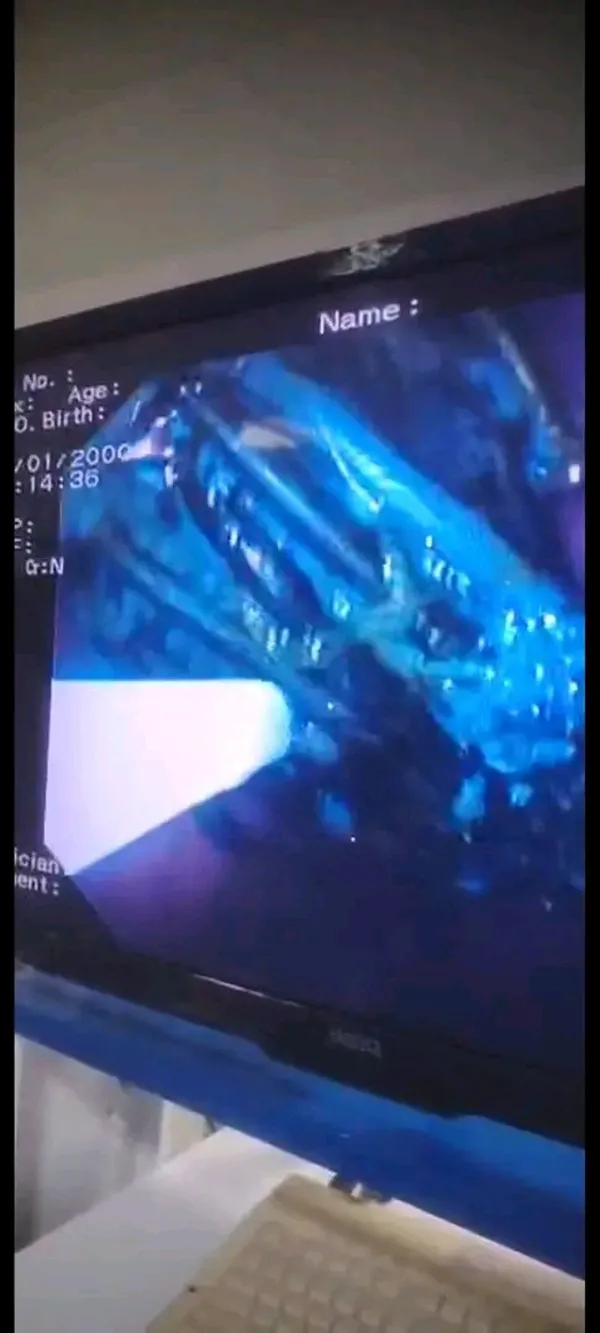 جانب من العملية الجراحية 