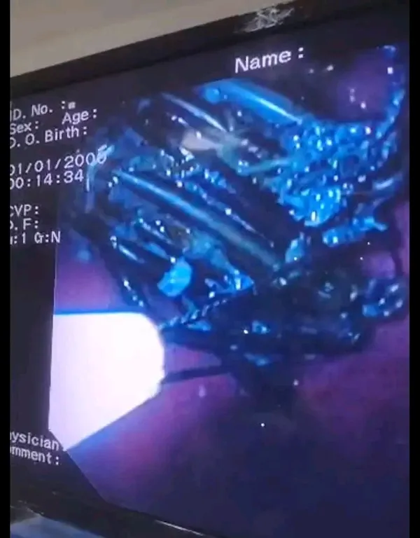 جانب من العملية الجراحية 