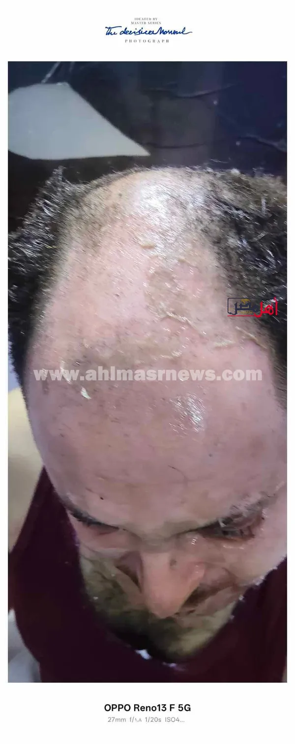 زغلول فرج الله، المجني عليه 