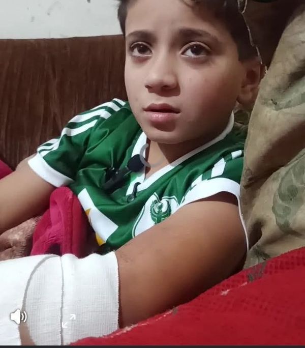 الطفل ادام الذى عقره كلب ضال ببورسعيد 