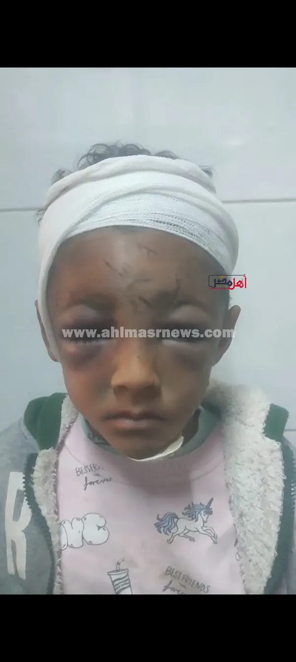 الطفل المصاب