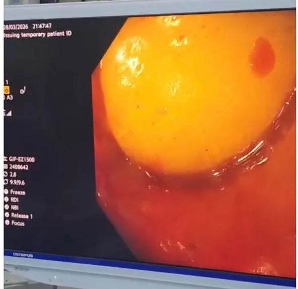 جانب من العملية 