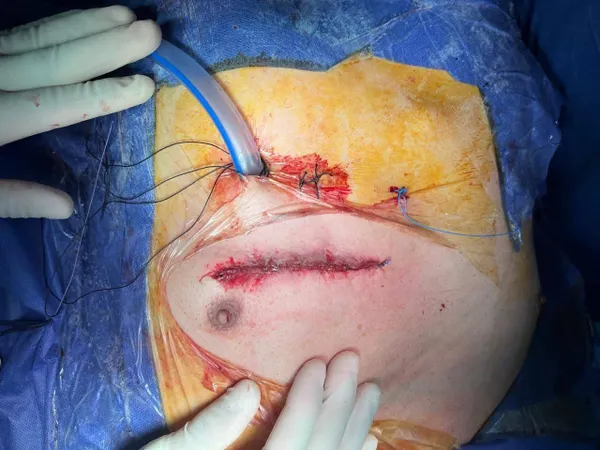 جانب من العملية الجراحية 