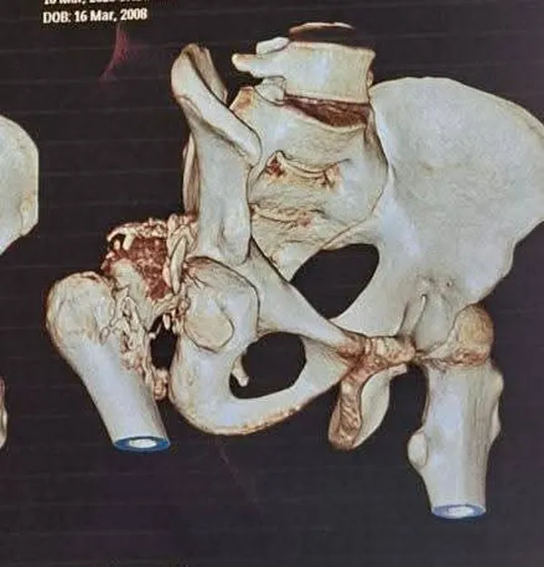 جانب من العملية الجراحية 