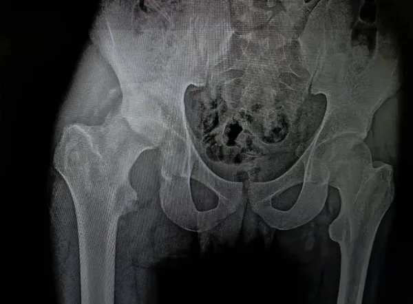 جانب من العملية الجراحية 