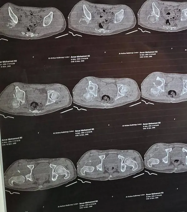 جانب من العملية الجراحية 