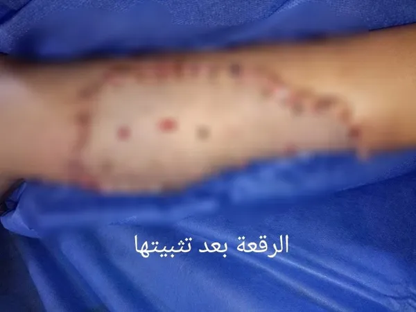 الحالة بعد إجراء العملية 