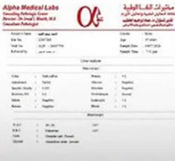 التحاليل 