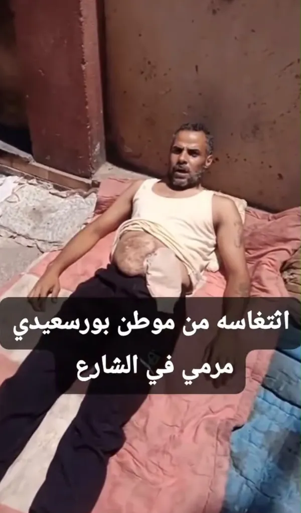  محافظ بورسعيد يستقبل مواطن  ويوجه بصرف دعم مالي عاجل.. والتنسيق مع هيئة الرعاية الصحية لإجراء العملية الجراحية اللازمة