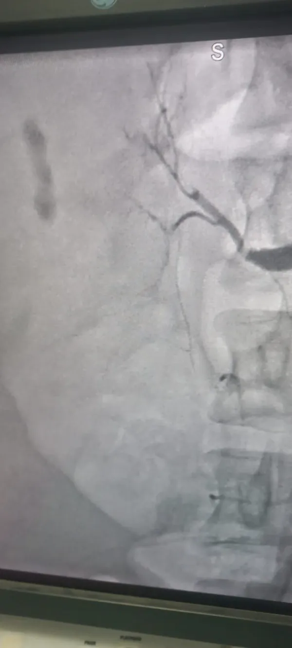 عملية جراحية مستشفى جامعة بنى سويف 