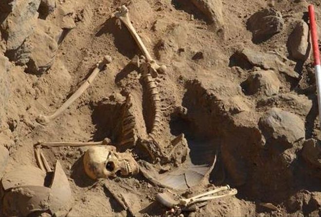 علماء آثار يرصدون أدلة على نجاح عمليات بتر جراحي قبل 31 ألف عام أهل مصر
